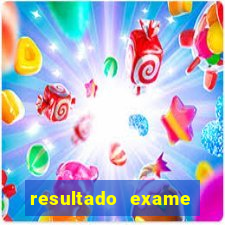 resultado exame eliel figueiredo